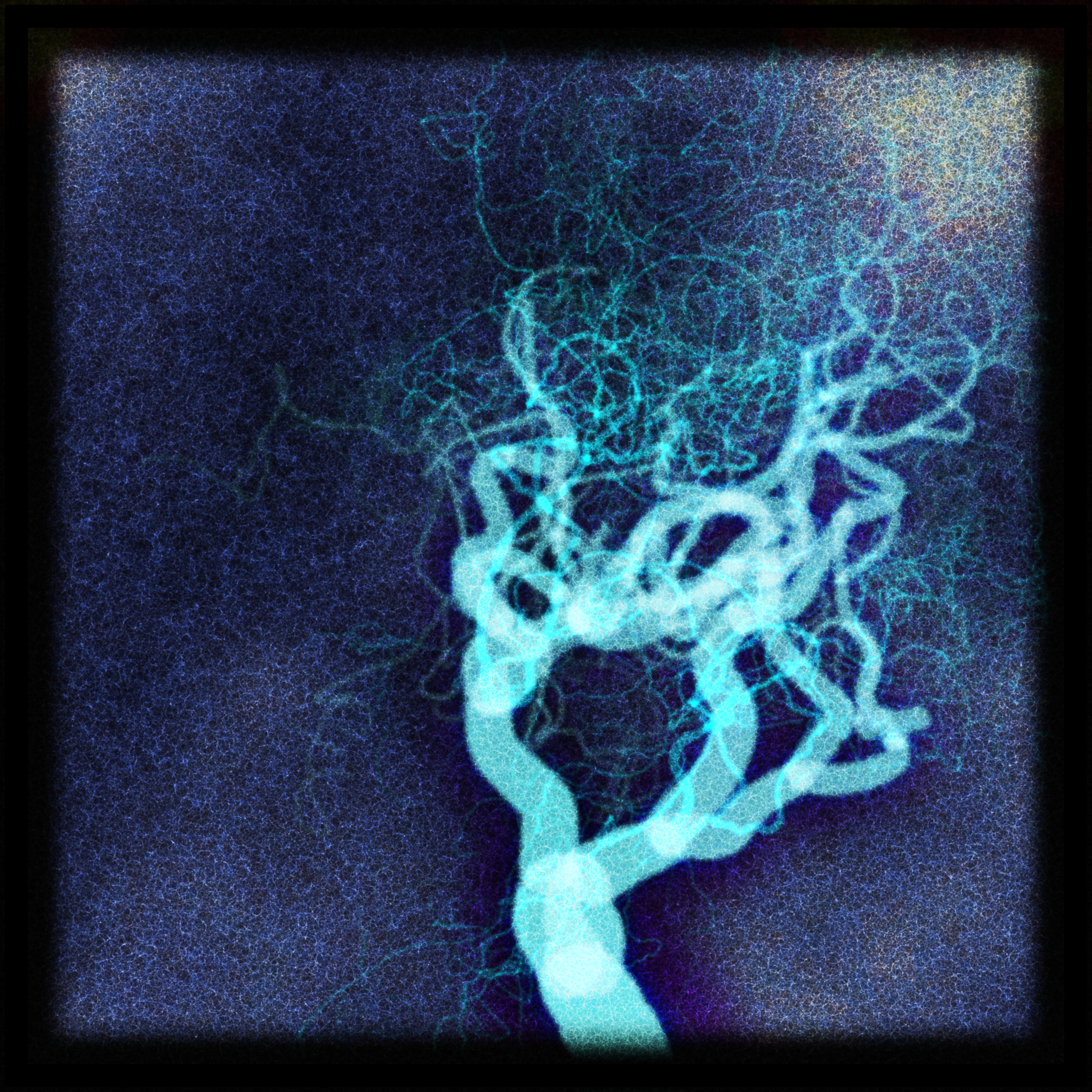Image générative d'un arbre comme un réseau bleu lumineux sur un fond sombre, ses branches, des filaments rayonnants tels des nerfs ou des vaisseaux enfilés de nœuds brillants - le naturel et le fabriqué entrelacés.
