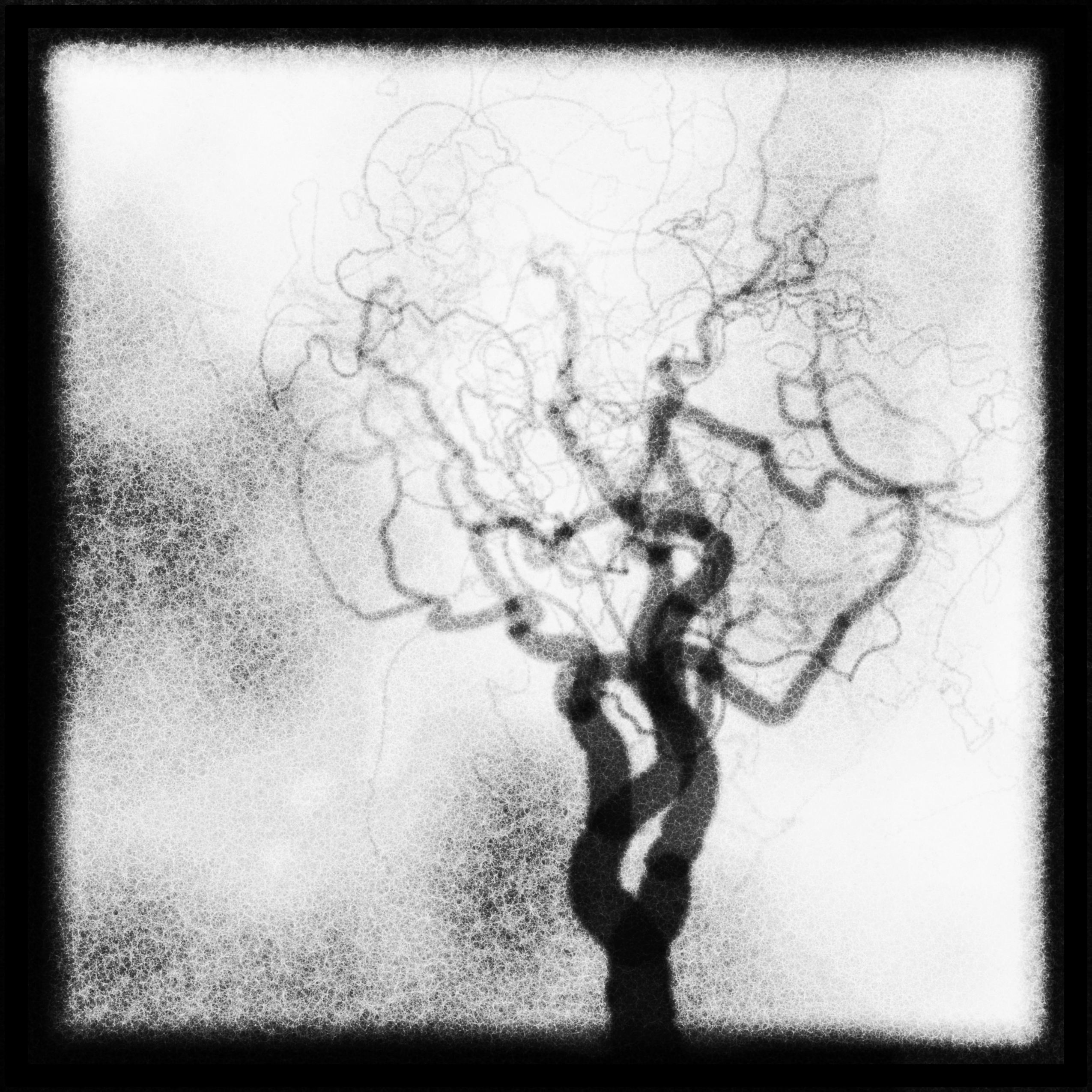 Generative image of a tree in black on a grainy pale ground like an angiogram, its braided trunk opening into a wide canopy of looping, vessel-like branches fading to fine tendrils.